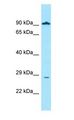 GLIPR1 / GLIPR Antibody - GLIPR1 / GLIPR antibody Western Blot of MCF7.  This image was taken for the unconjugated form of this product. Other forms have not been tested.