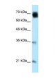 GLMN Antibody - GLMN antibody Western blot of HeLa Cell lysate. Antibody concentration 1 ug/ml. This image was taken for the unconjugated form of this product. Other forms have not been tested.