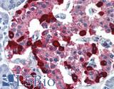 GLP2 Antibody - Human Pancreas: Formalin-Fixed, Paraffin-Embedded (FFPE)