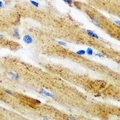 GLRX3 / Glutaredoxin 3 Antibody - Immunohistochemical analysis of PICOT staining in mouse heart formalin fixed paraffin embedded tissue section. The section was pre-treated using heat mediated antigen retrieval with sodium citrate buffer (pH 6.0). The section was then incubated with the antibody at room temperature and detected using an HRP conjugated compact polymer system. DAB was used as the chromogen. The section was then counterstained with hematoxylin and mounted with DPX.