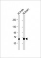 GLS / Glutaminase Antibody - All lanes: Anti-GLS Antibody (N-Term) at 1:2000 dilution. Lane 1: human brain lysate. Lane 2: mouse brain lysate Lysates/proteins at 20 ug per lane. Secondary Goat Anti-Rabbit IgG, (H+L), Peroxidase conjugated at 1:10000 dilution. Predicted band size: 73 kDa. Blocking/Dilution buffer: 5% NFDM/TBST.
