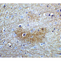 GLS2 / Glutaminase 2 Antibody - Immunohistochemistry of GLS2 in mouse brain tissue with GLS2 Antibodyat 5 µg/mL.