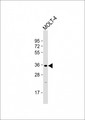GLT6D1 Antibody - Anti-GLT6D1 Antibody (Center) at 1:2000 dilution + MOLT-4 whole cell lysate Lysates/proteins at 20 µg per lane. Secondary Goat Anti-Rabbit IgG, (H+L), Peroxidase conjugated at 1/10000 dilution. Predicted band size: 36 kDa Blocking/Dilution buffer: 5% NFDM/TBST.
