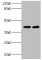 GLT8D2 Antibody - Western blot All lanes: Glycosyltransferase 8 domain-containing protein 2 antibody at 2µg/ml Lane 1: Mouse heart tissue Lane 2: Mouse kidney tissue Secondary Goat polyclonal to rabbit IgG at 1/10000 dilution Predicted band size: 40 kDa Observed band size: 40 kDa