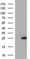 GLTP Antibody - HEK293T cells were transfected with the pCMV6-ENTRY control (Left lane) or pCMV6-ENTRY GLTP (Right lane) cDNA for 48 hrs and lysed. Equivalent amounts of cell lysates (5 ug per lane) were separated by SDS-PAGE and immunoblotted with anti-GLTP.