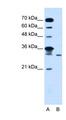 GLTPD2 Antibody - GLTPD2 antibody ARP44688_T100-NP_001014985-LOC388323(hypothetical LOC388323) Antibody Western blot of Jurkat lysate.  This image was taken for the unconjugated form of this product. Other forms have not been tested.