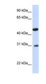 GLTPD2 Antibody - GLTPD2 antibody Western blot of Fetal Muscle lysate. This image was taken for the unconjugated form of this product. Other forms have not been tested.