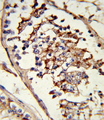 GLUL / Glutamine Synthetase Antibody - Formalin-fixed and paraffin-embedded human testis tissue reacted with GLUL Antibody , which was peroxidase-conjugated to the secondary antibody, followed by DAB staining. This data demonstrates the use of this antibody for immunohistochemistry; clinical relevance has not been evaluated.