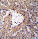 GLYAT Antibody - GLYAT Antibody immunohistochemistry of formalin-fixed and paraffin-embedded human liver tissue followed by peroxidase-conjugated secondary antibody and DAB staining.