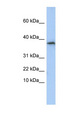 GLYAT Antibody - GLYAT antibody Western blot of HepG2 cell lysate. This image was taken for the unconjugated form of this product. Other forms have not been tested.