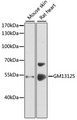 Gm13125 Antibody - Western blot analysis of extracts of various cell lines, using GM13125 antibody at 1:1000 dilution. The secondary antibody used was an HRP Goat Anti-Rabbit IgG (H+L) at 1:10000 dilution. Lysates were loaded 25ug per lane and 3% nonfat dry milk in TBST was used for blocking. An ECL Kit was used for detection and the exposure time was 30s.