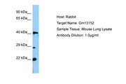 Gm13152 Antibody -  This image was taken for the unconjugated form of this product. Other forms have not been tested.