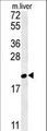 GM2A Antibody - GM2A Antibody western blot of mouse liver tissue lysates (35 ug/lane). The GM2A antibody detected the GM2A protein (arrow).