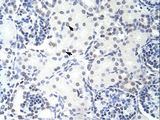 GMEB2 Antibody - GMEB2 antibody ARP38990_T100-NP_036516-GMEB2 (glucocorticoid modulatory element binding protein 2) Antibody was used in IHC to stain formalin-fixed, paraffin-embedded human kidney.  This image was taken for the unconjugated form of this product. Other forms have not been tested.