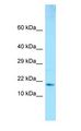 GMF Beta / GMFB Antibody - GMF Beta / GMFB antibody Western Blot of Fetal Brain.  This image was taken for the unconjugated form of this product. Other forms have not been tested.