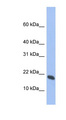 GMFG Antibody - GMFG antibody Western blot of Fetal Thymus lysate. This image was taken for the unconjugated form of this product. Other forms have not been tested.