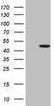 GNA15 Antibody - HEK293T cells were transfected with the pCMV6-ENTRY control (Left lane) or pCMV6-ENTRY GNA15 (Right lane) cDNA for 48 hrs and lysed. Equivalent amounts of cell lysates (5 ug per lane) were separated by SDS-PAGE and immunoblotted with anti-GNA15 (1:2000).