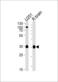 GNAO1 Antibody - GNAO1 Antibody western blot of U251 cell line and rat brain lysates (35 ug/lane). The GNAO1 antibody detected the GNAO1 protein (arrow).