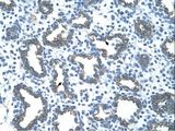 GNAS Antibody - GNAS antibody ARP42694_T100-NP_536351-GNAS(GNAS complex locus) Antibody was used in IHC to stain formalin-fixed, paraffin-embedded human lung.  This image was taken for the unconjugated form of this product. Other forms have not been tested.