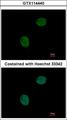 GNAT2 Antibody - Immunofluorescence of paraformaldehyde-fixed HeLa using GNAT2 antibody at 1:500 dilution.