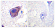 GNAZ Antibody - Immunohistochemistry analysis of paraffin-embedded human brain tissue, using Gz-alpha Antibody. The picture on the right is blocked with the synthesized peptide.