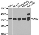 GNB2 Antibody - Western blot analysis of extracts of various cells.