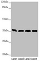GNB2 Antibody - Western blot All Lanes:GNB2 antibody at 1.87 ug/ml Lane 1: Mouse liver tissue Lane 2: Mouse lung tissue Lane 3: NIH/3T3 whole cell lysate Lane 4: Jurkat whole cell lysate Secondary Goat polyclonal to rabbit IgG at 1/10000 dilution Predicted band size: 38,26 kDa Observed band size: 37 kDa