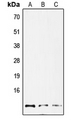 GNG12 Antibody - Western blot analysis of GNG12 expression in HepG2 (A); mouse lung (B); rat lung (C) whole cell lysates.