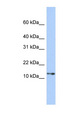 GNGT2 Antibody - GNGT2 antibody Western blot of 293T cell lysate. This image was taken for the unconjugated form of this product. Other forms have not been tested.