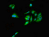 GNL1 Antibody - Immunofluorescent analysis of Hela cells using GNL1 Antibody at dilution of 1:100 and Alexa Fluor 488-congugated AffiniPure Goat Anti-Rabbit IgG(H+L)