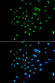 GNL3 / NS / Nucleostemin Antibody - Immunofluorescence analysis of A549 cells.