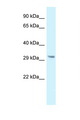 GNMT Antibody - GNMT antibody Western blot of Small Intestine lysate. Antibody concentration 1 ug/ml.  This image was taken for the unconjugated form of this product. Other forms have not been tested.