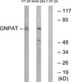 GNPAT / DHAP-AT Antibody - Western blot analysis of lysates from HT-29 and RAW264.7 cells, using GNPAT Antibody. The lane on the right is blocked with the synthesized peptide.
