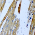 GNT-III / MGAT3 Antibody - Immunohistochemical analysis of GnT-III staining in rat heart formalin fixed paraffin embedded tissue section. The section was pre-treated using heat mediated antigen retrieval with sodium citrate buffer (pH 6.0). The section was then incubated with the antibody at room temperature and detected using an HRP conjugated compact polymer system. DAB was used as the chromogen. The section was then counterstained with hematoxylin and mounted with DPX.