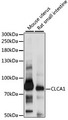 GOB5 / CLCA1 Antibody - Western blot analysis of extracts of various cell lines, using CLCA1 antibody at 1:1000 dilution. The secondary antibody used was an HRP Goat Anti-Rabbit IgG (H+L) at 1:10000 dilution. Lysates were loaded 25ug per lane and 3% nonfat dry milk in TBST was used for blocking. An ECL Kit was used for detection and the exposure time was 20s.