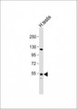 GOLGA6L2 Antibody - Anti-GOLGA6L2 Antibody (N-term) at 1:1000 dilution + human testis lysate Lysates/proteins at 20 µg per lane. Secondary Goat Anti-Rabbit IgG, (H+L), Peroxidase conjugated at 1/10000 dilution. Predicted band size: 79 kDa Blocking/Dilution buffer: 5% NFDM/TBST.