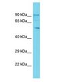GOLGA6L2 Antibody - GOLGA6L2 antibody Western Blot of THP-1. Antibody dilution: 1 ug/ml.  This image was taken for the unconjugated form of this product. Other forms have not been tested.