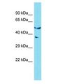 GOLGA6L2 Antibody - GOLGA6L2 antibody Western Blot of 293T. Antibody dilution: 1 ug/ml.  This image was taken for the unconjugated form of this product. Other forms have not been tested.