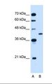 GOT2 Antibody - Lane A: Marker. Lane B: HepG2 cell lysate. Antibody concentration: 2.5 ug/ml. Gel concentration: 12%.  This image was taken for the unconjugated form of this product. Other forms have not been tested.