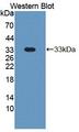 GP1BA / CD42b Antibody - Western blot of GP1BA / CD42b antibody.