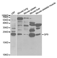 GP9 / CD42a Antibody - Western blot analysis of extracts of various cell lines, using GP9 antibody.