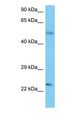 GPALPP1 / KIAA1704 Antibody - Western blot of GPAM1 Antibody with human Thymus Tumor lysate.  This image was taken for the unconjugated form of this product. Other forms have not been tested.