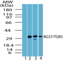 GPBAR1 / TGR5 Antibody - Western blot of BG37/TGR5 in spleen lysate. Lane 1 shows pre-immune sera. Lanes 2, 3 and 4 show antibody tested on human (1:1000), mouse (1:5000) and rat (1:5000) spleen lysate, respectively.
