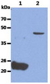 GPC4 / Glypican 4 Antibody - The Recombinant Human GPC4 (50ng) and Cell lysate (40ug) were resolved by SDS-PAGE, transferred to PVDF membrane and probed with anti-human GPC4 anibody (1:1000). Proteins were visualized using a goat anti-mouse secondary antibody conjugated to HRP and an ECL detection system. Lane 1. : Recombinant Human GPC4 Lane 2. : Ramos cell lysate