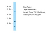 GPC6 / Glypican 6 Antibody -  This image was taken for the unconjugated form of this product. Other forms have not been tested.