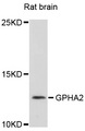 GPHA2 Antibody - Western blot analysis of extracts of rat brain, using GPHA2 antibody at 1:1000 dilution. The secondary antibody used was an HRP Goat Anti-Rabbit IgG (H+L) at 1:10000 dilution. Lysates were loaded 25ug per lane and 3% nonfat dry milk in TBST was used for blocking. An ECL Kit was used for detection and the exposure time was 30s.
