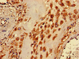 GPI3 / PIGA Antibody - Immunohistochemistry image of paraffin-embedded human placenta tissue at a dilution of 1:100