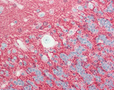 GPM6A / Glycoprotein M6A Antibody - Human Brain, Cerebellum: Formalin-Fixed, Paraffin-Embedded (FFPE).  This image was taken for the unconjugated form of this product. Other forms have not been tested.