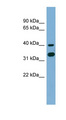 GPN2 Antibody - GPN2 / ATPBD1B antibody Western blot of NCI-H226 cell lysate. This image was taken for the unconjugated form of this product. Other forms have not been tested.