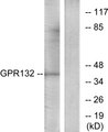 GPR132 / G2A Antibody - Western blot analysis of lysates from Jurkat cells, using GPR132 Antibody. The lane on the right is blocked with the synthesized peptide.